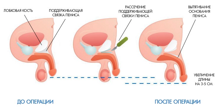 742x372