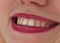 606x436