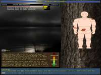 1332x1000